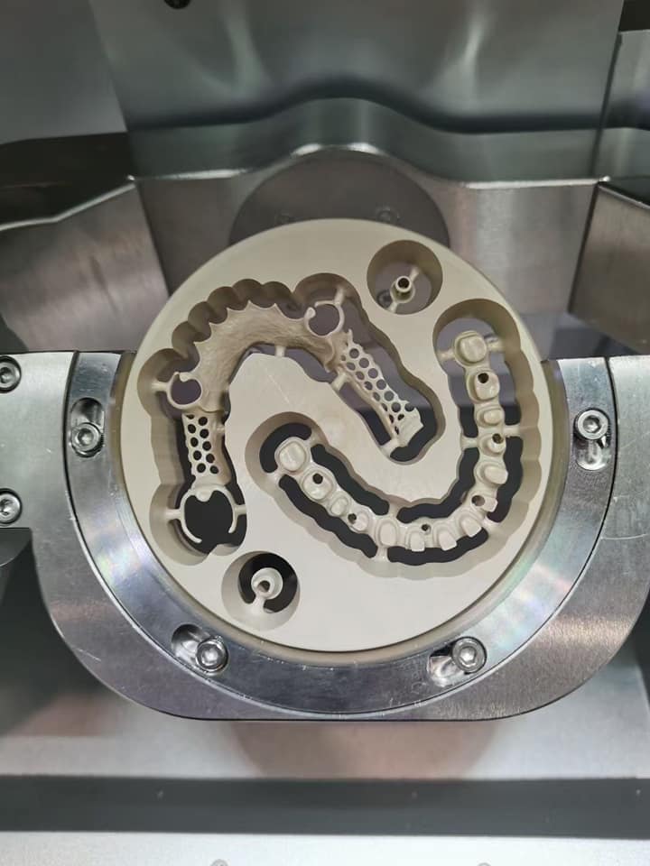 PEEK Milling Discs – 5 Pieces – Assorted Colours CAD/CAM